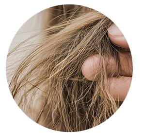 Beispiel für stumpfes Haar ohne Glanz