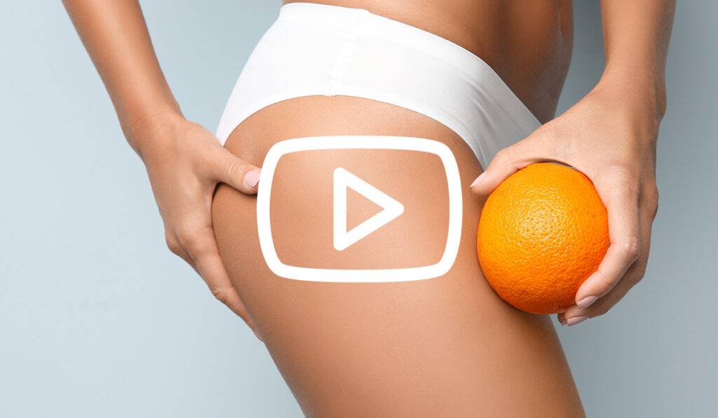 Cellulite verstehen, verhindern und wieder loswerden